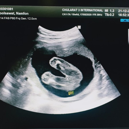 19w ญ/ช ค่ะ