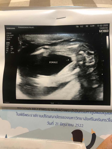 ถามเรื่องเพศคะ