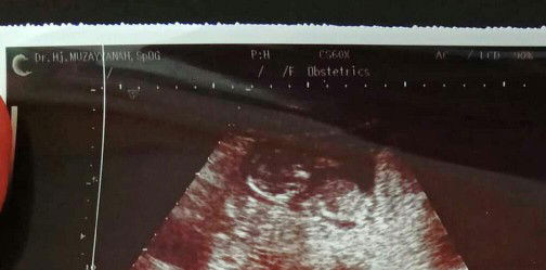 Siti Asiyah Fitria Amin profile icon