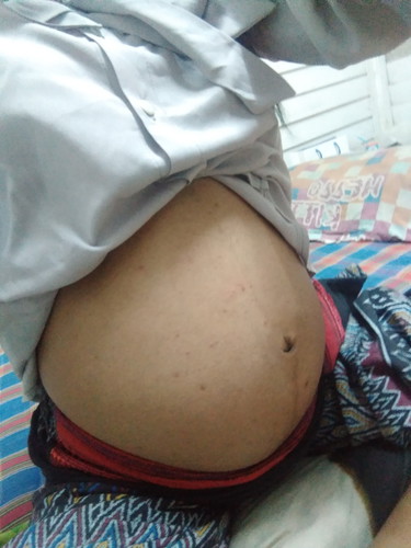 ขอดูท้องแม่หน่อย
