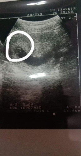 การตั้งครรถ์ค่ะ