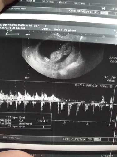 15weeks pregnant