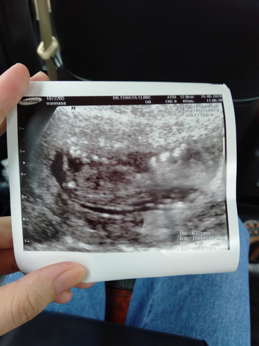 แบบนี้เห็นเพศรึยัง 12w6d
