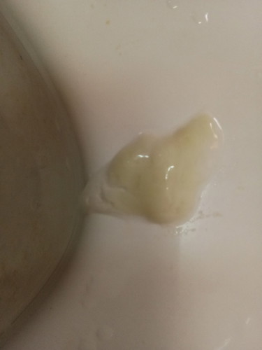 Mucus Plug