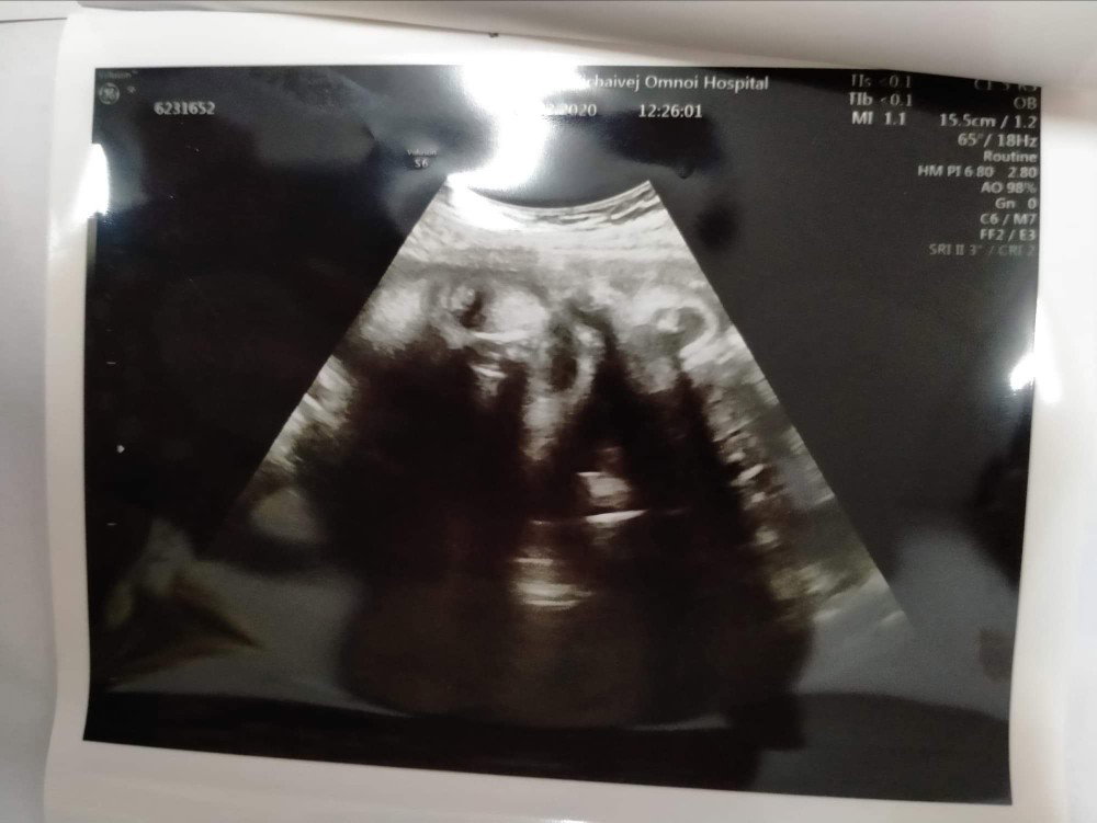 oilly mickey profile icon