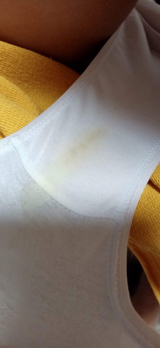 Can you tell why I still get yellow discharge?