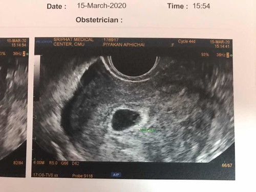 ในที่สุดน้องก็มา