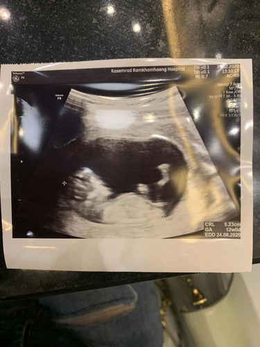 เห่อลูกค่ะ?