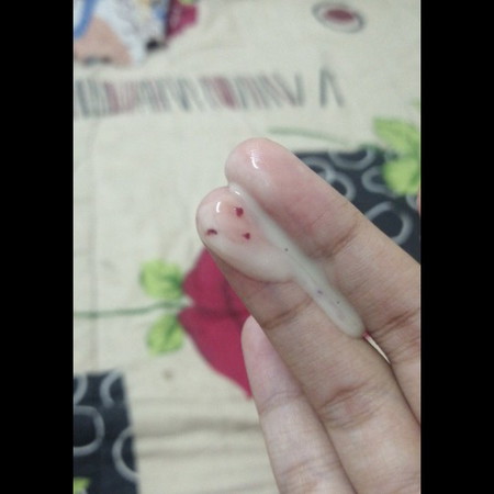 kenapa ye ade keluar keputihan dan sedikit darah