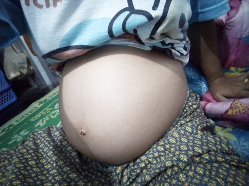 ท้องเล็กไปมั้ยคะ?