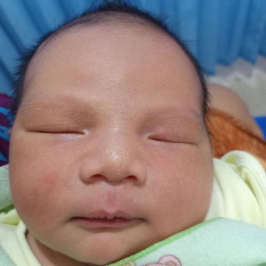 Bintik putih dihidung