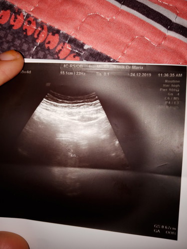 saiz kecik . mommy risauuu