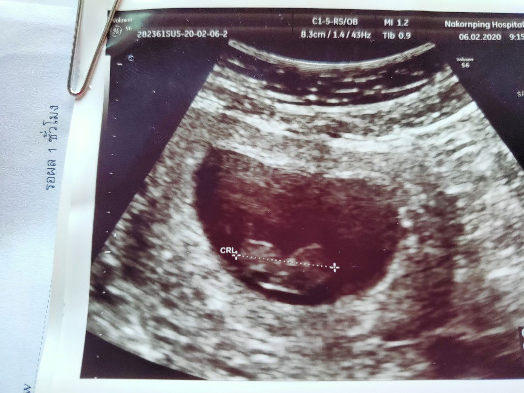 รอปาฎิหารย์น้องพอเพียง