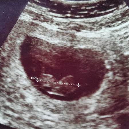 R.I.P. #น้องพอเพียง