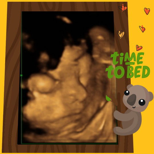 Gerakan Bayi dalam Perut