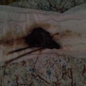 Mucus plug at 39 weeks and 3 days