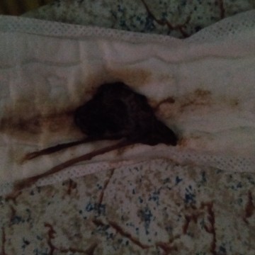 Mucus plug at 39 weeks and 3 days