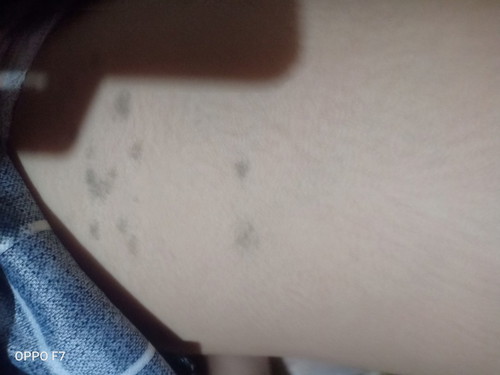 Cause of pregnancy ba Ni cya ?