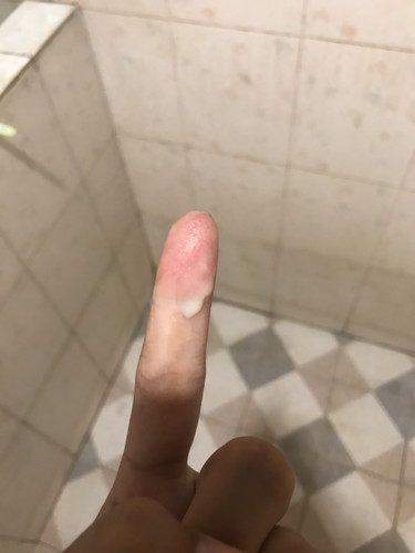 เเม่ๆค่ะอันนี้คืออะไรค่ะ