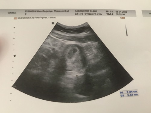 อัลตร้าซาว