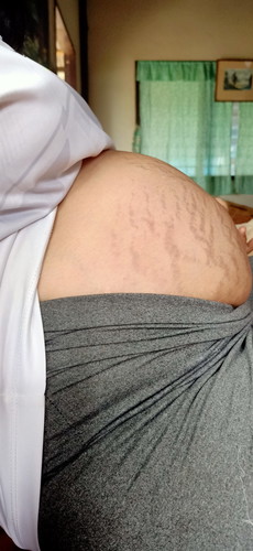 รอยแตกทีสวยงาม