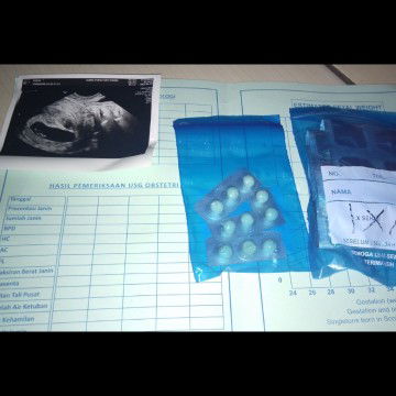 efek flek buat khawatir ? sampe harus cek up