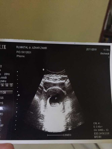 Ia yang tak berdetak