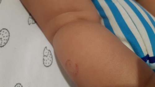 apa ni? parut cakar kucing atau kudis?