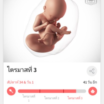 34 สัปดาห์จ้าใครมีอาการเวียนหัวหน้ามืดคลื่นไส้อาเจียนเจ็บท้องจี๊ดๆเหมือนมดกัดอัดแน่นท้องเหนื่อยง่ายๆเดินๆเหมือนมดลูกจะหลุดบ้างไหมคะ