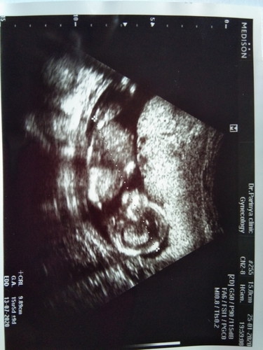 15W5D