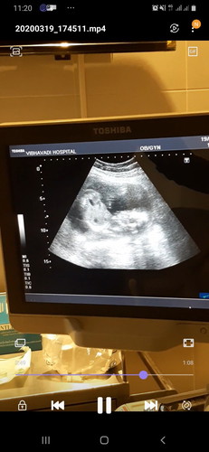 ไตหาย1ข้าง