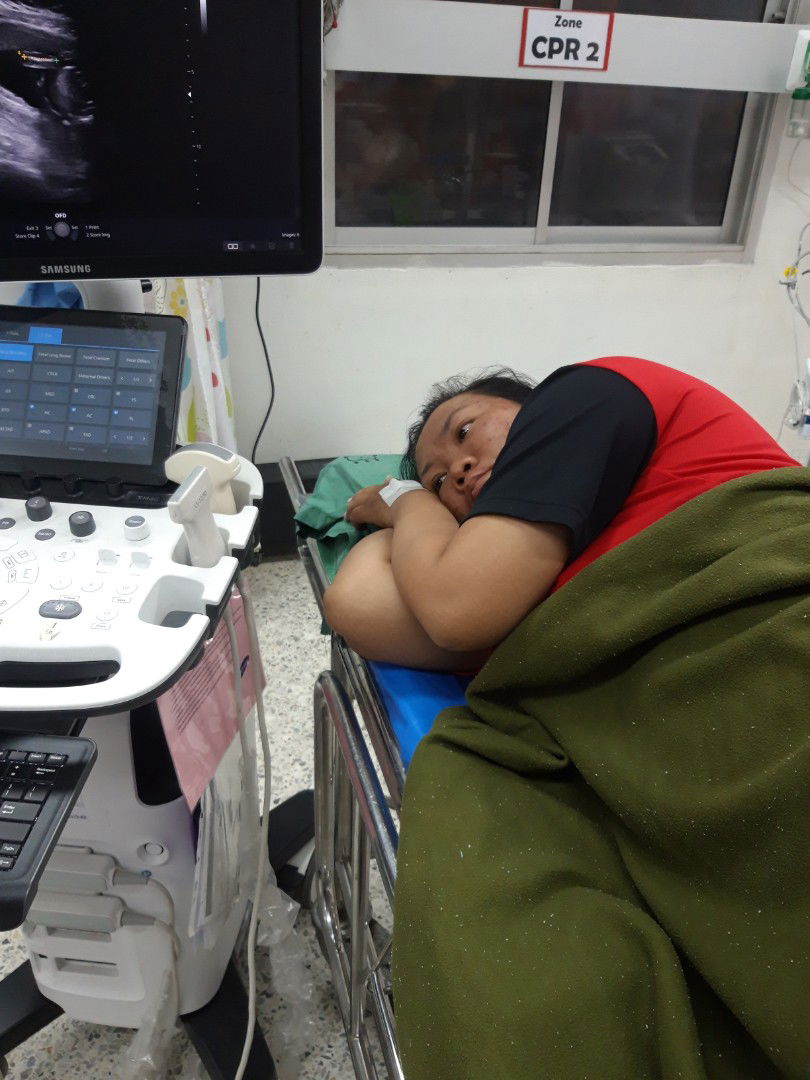 เล่าประสพการ์ณ เท้า-ขา บวมเสียงครรภ์เป็นพิษของภรรยา