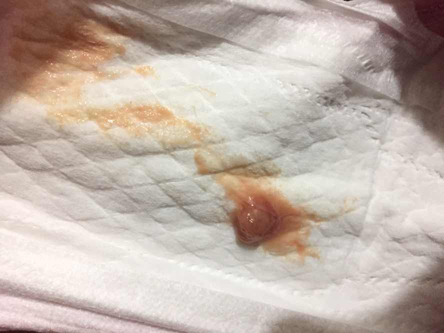 ใช่มูกเลือดหรือเปล่า??