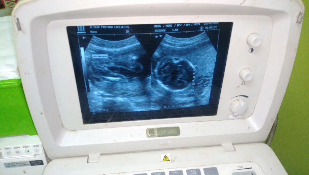 yang menanti baby girl