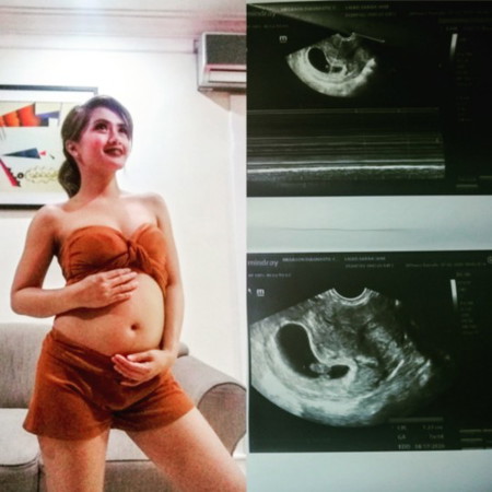 Ask ko lang normal namn sa mga tulad kong bago lang sa pagbubuntis ang ganito kalaking tyan na pa puntang 3months palang?
