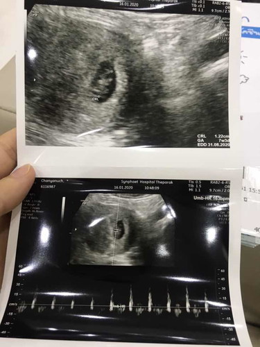 7week
