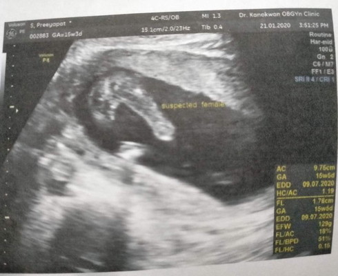 แม่ๆค่ะช่วยบอกที อันนี้เพศอะไร