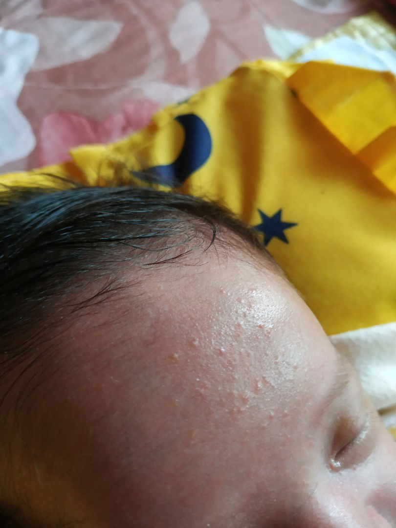 Merintis Bayi 15 Hari