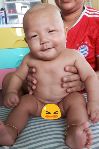 น้องจะคอเอียงไหมบ้านไหนเคยเป็นบ้าง