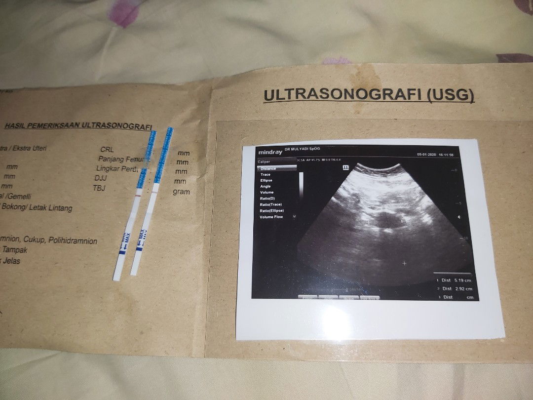 telat 2 bulan hasil negatif