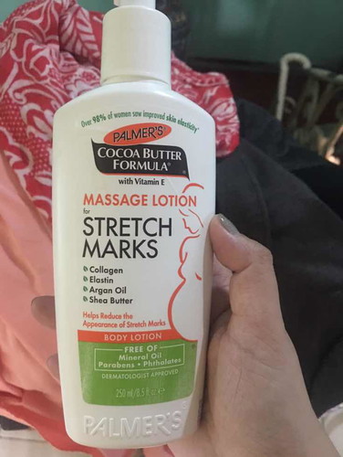 Anti-stretch marks cream or lotion?