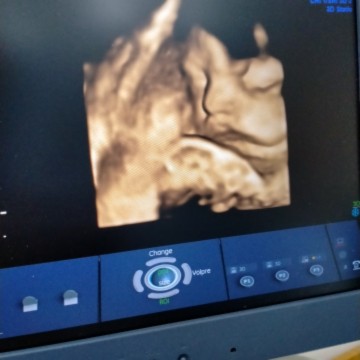 ลูกสาว