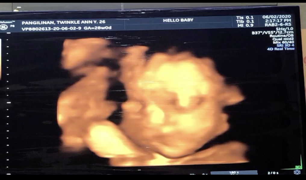 Twinkle Ann Pangilinan profile icon