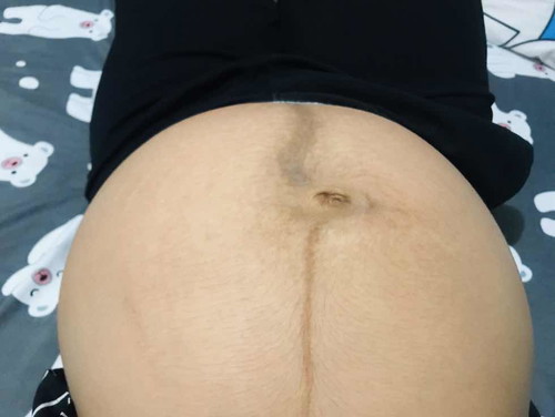 ท้องดำมาก?