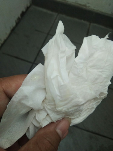 มูกใสเหลืองเป็นไรไหมค่ะ