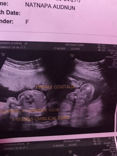 แบบนี้จะผิดพลาดใหมคะ