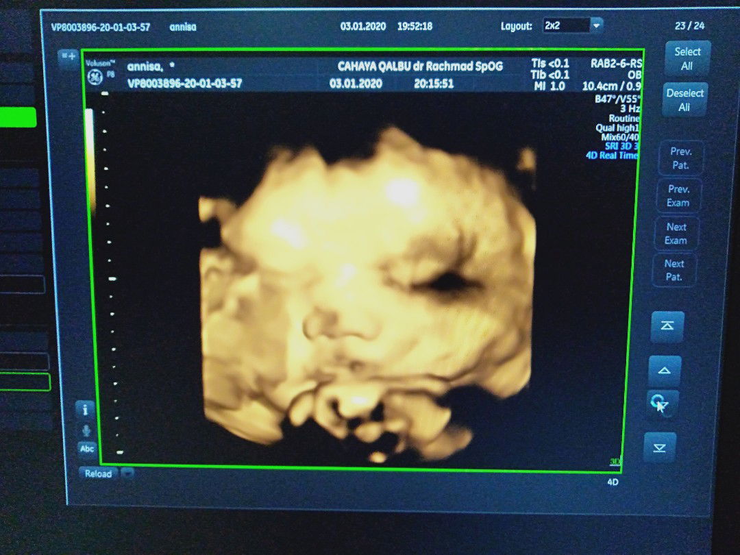 Arcilely profile icon