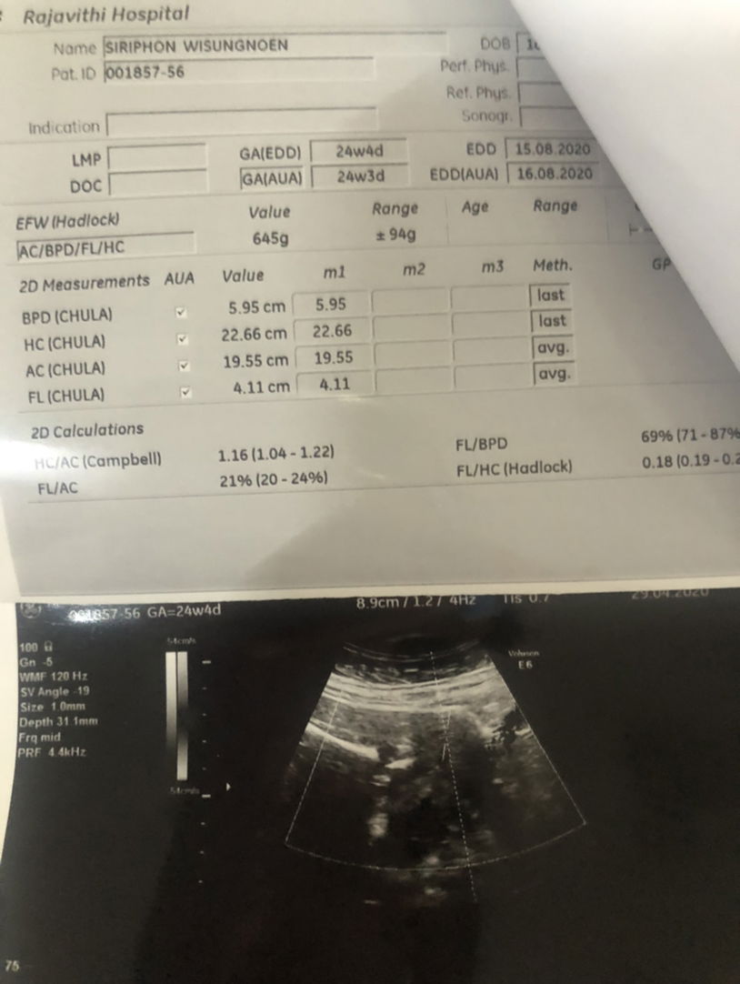 24+4 วีค แม่ทีมสิงหา