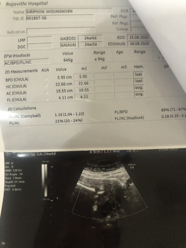 24+4 วีค แม่ทีมสิงหา