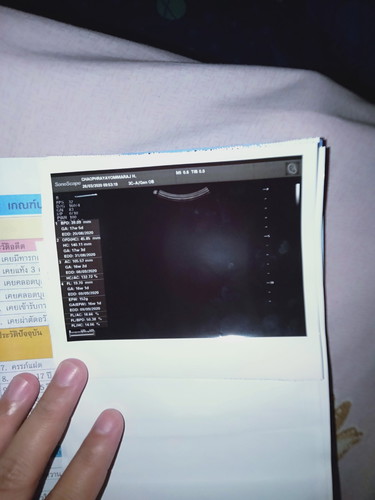 กลัวลูกจะเป็นไร?